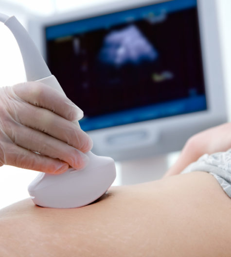 woman getting ultrasound diagnostic from doctor